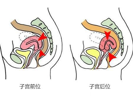 显示子宫的位置