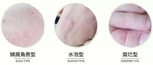 脚臭不敢脱鞋？教你一招，一喷10秒除臭，7天不臭脚，不再尴尬啦