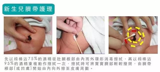 网传：宝宝出生四周肚脐发炎去世，新生儿肚脐护理刻不容缓！