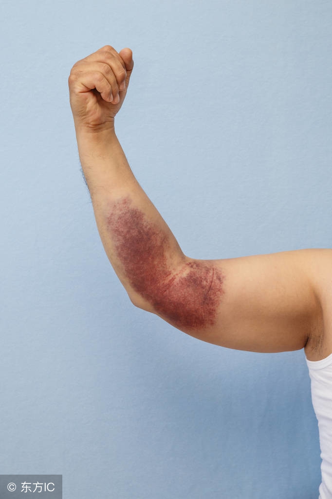 辟谣:冠心病都要做心脏造影?医生:造影有危险,选择需慎重!