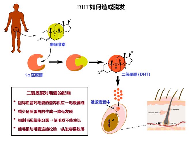 雄激素高——男性秃顶的祸根人体的雄性激素(睾酮素),会在5α还原