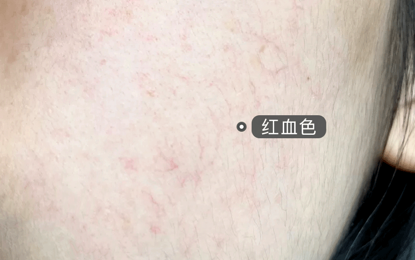 從明朝火到現在的國貨經典，洗洗臉就能祛痘