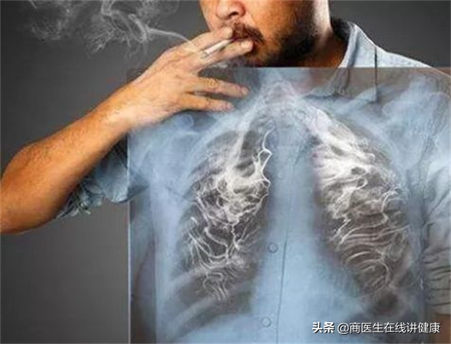 如何让你的肺结节变小甚至消失？