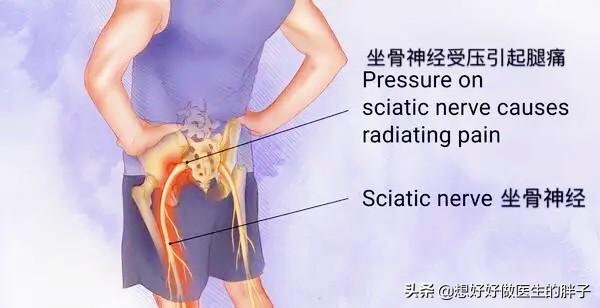 CT发现腰突、椎管狭窄、骨刺先别怕！医生：抛开症状谈检查不靠谱