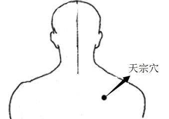 肩胛骨疼痛？1个手法，有效缓解疼痛