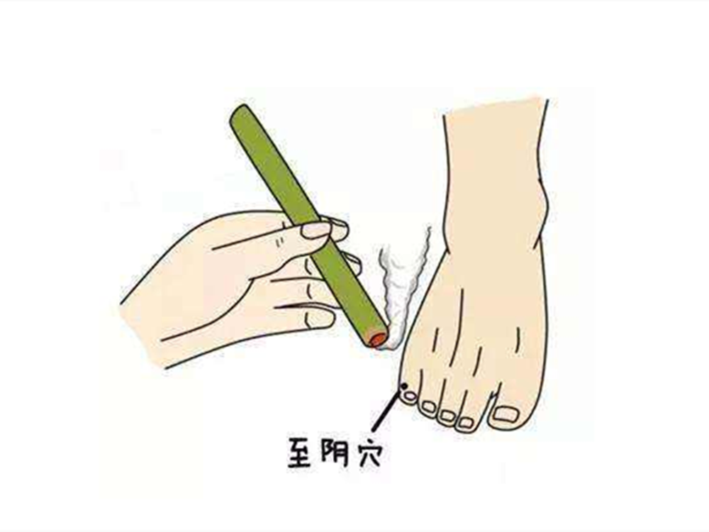 遇上胎位不正的情况，这些纠正方法，孕妈们可以了解一下