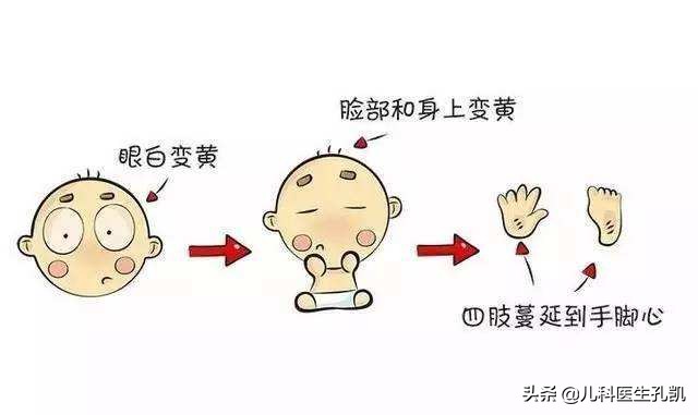 宝宝黄疸怎么办？生理性黄疸、病理性黄疸、母乳性黄疸如何区分？