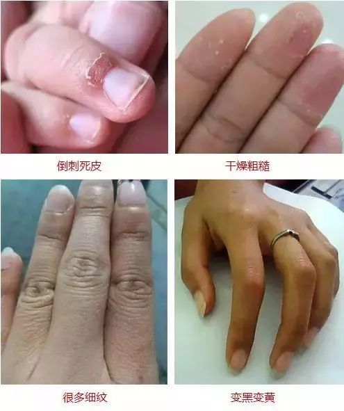 手纹深干燥、粗糙真显老！这支法国“换皮护手霜”，拯救干燥皱纹