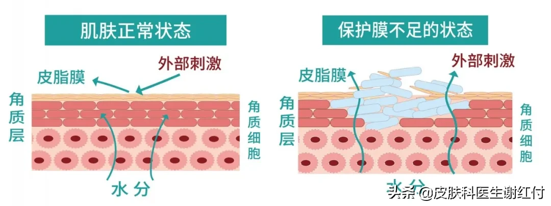 皮肤屏障受损后，如何科学恢复成健康肌？