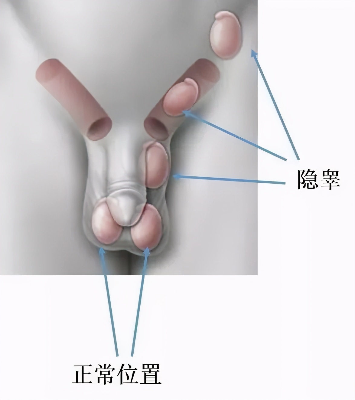 “蛋蛋”离家出走？家长注意，孩子出现这种情况尽快就医