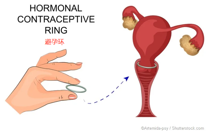 吃避孕药，会把性激素传给宝宝？怎么避孕最安全？