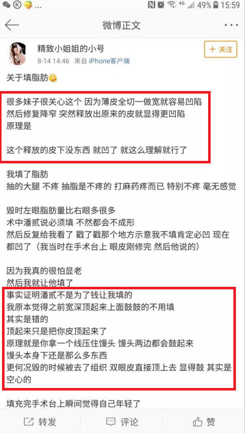 双眼皮修复之上睑”鼓鼓“的，为啥还要填脂肪？