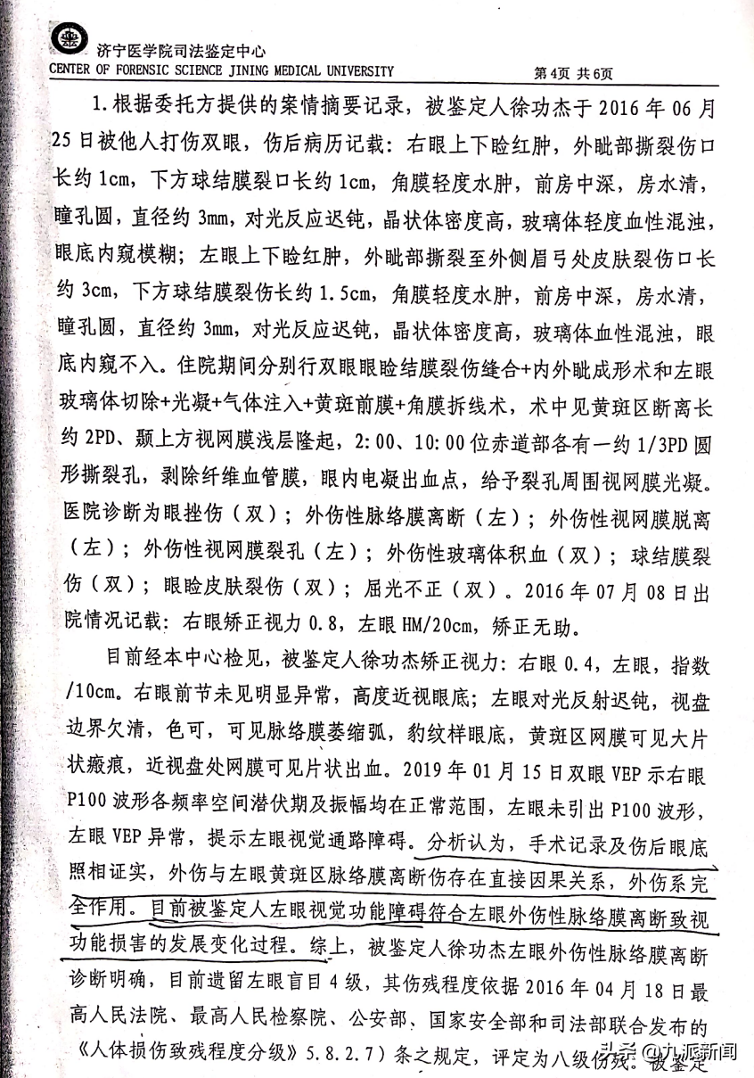 中学教师左眼被打失明，哥哥获刑一年缓刑两年，当事人指控实为嫂子抠的，但遭否认