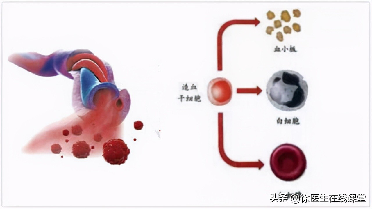 越来越多孩子得白血病，家长注意：孩子有3大异常，需及时排查