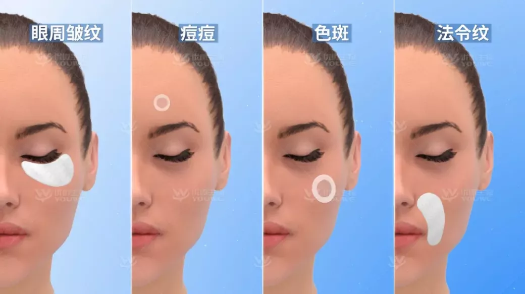 科学主义盛行，医药级技术「可溶性微针」下沉至美妆领域