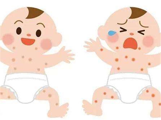 濕疹反復折磨寶寶？嬰幼兒大部分濕疹，這些方法就可以治好，收藏