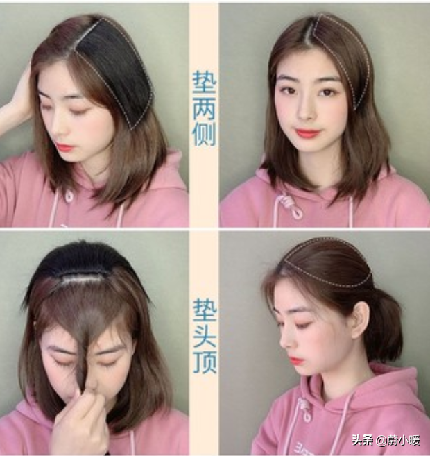 双商高的“顾佳”发际线堪忧！用对发量增多技巧，分分钟拯救颜值