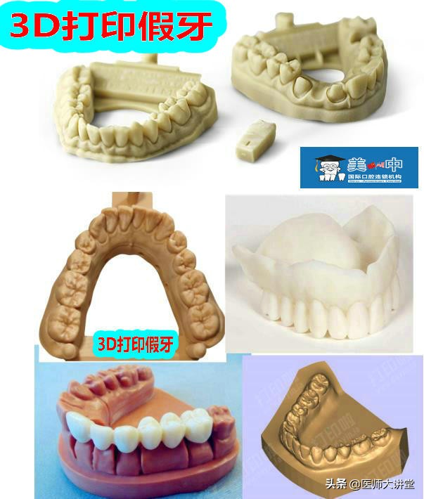「假牙新方法03」计算机设计和制造假牙你听说过吗？成本竟然更低