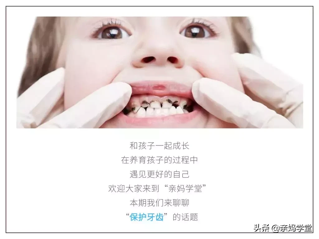 一千VS六万,治好孩子的满口坏牙到底要花多少钱?