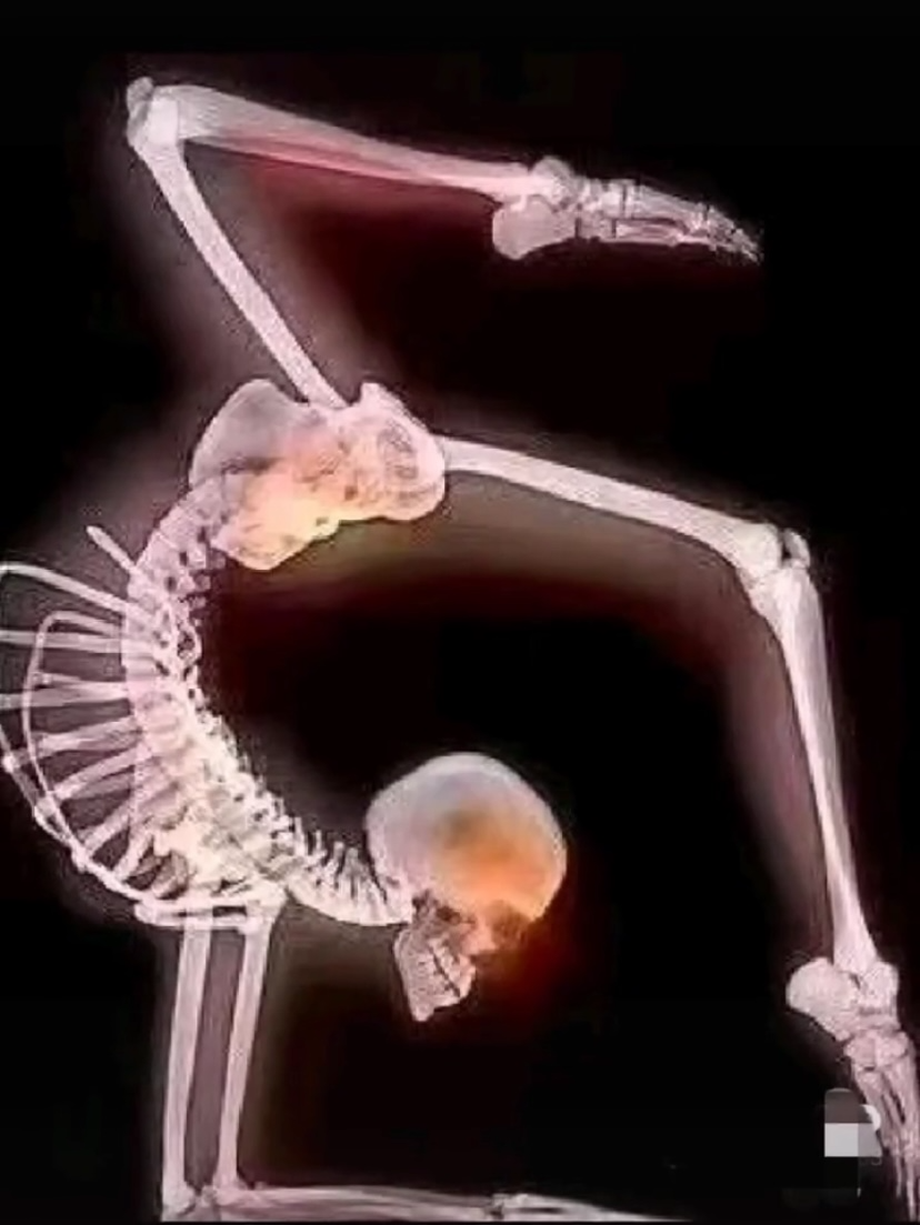 中国父母喜欢的舞蹈课外班，每年都有孩子在此瘫痪…