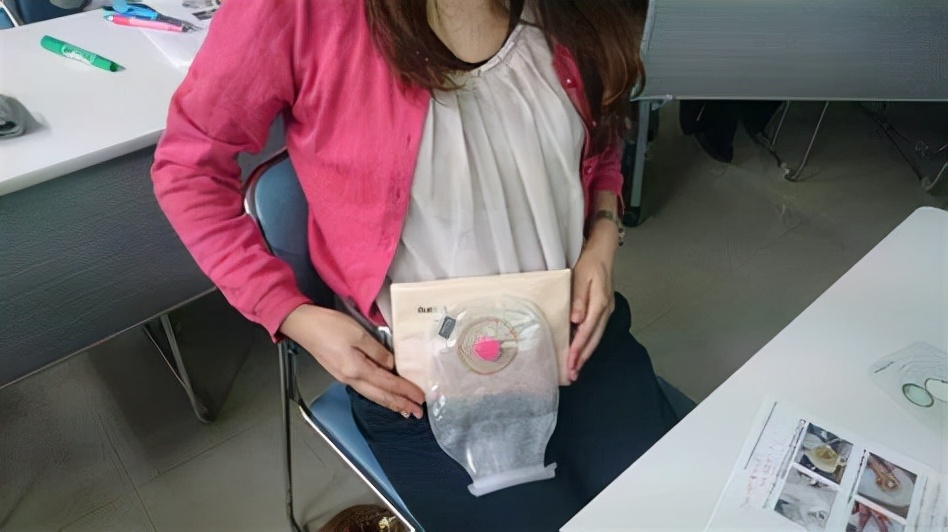 直肠癌，多半是“拖”出来的！提醒：身体出现3个症状，尽快排查