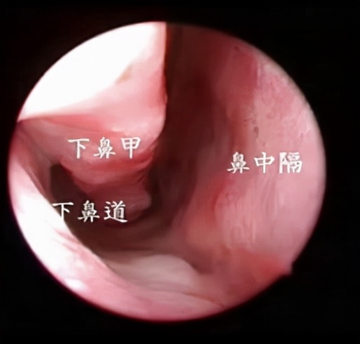 孩子早晨总是恶心、口臭，不一定是肠胃问题，可能是这个毛病