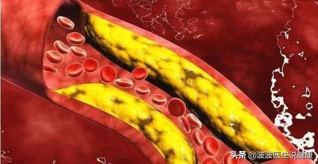 三高（高血压、高血脂、高血糖），哪一个对人的威胁和危害最大
