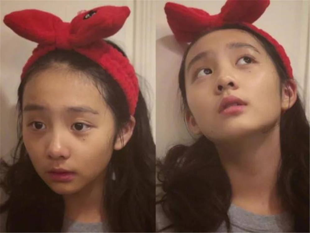 小孩下眼袋肿的图片(13岁的黄多多) - 赤虎壹号