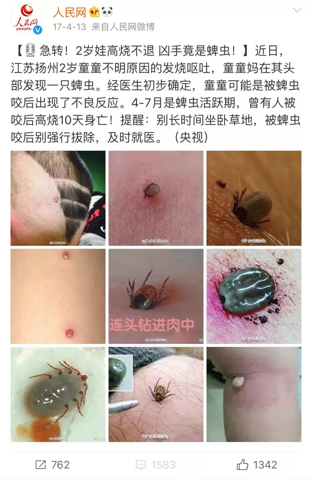 也许你总能发现类似这种蜱虫叮咬致死的新闻:一个多月来,安徽合肥安医