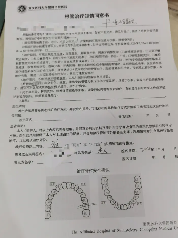 治牙记录①:坏牙根管治疗,想去看牙医的可以戳