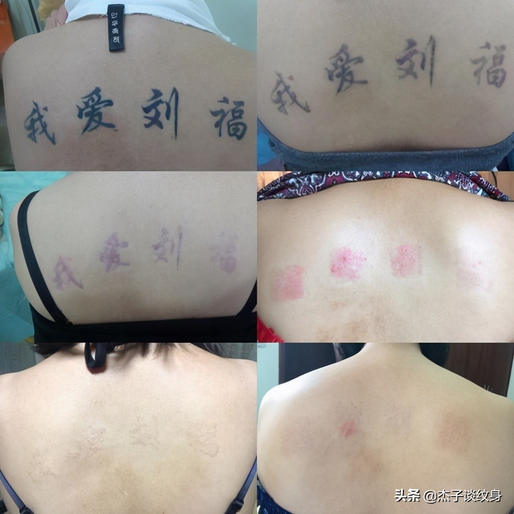 医美,美容店,美甲店,纹身店到处都在洗纹身,那到底谁能把纹身彻底洗