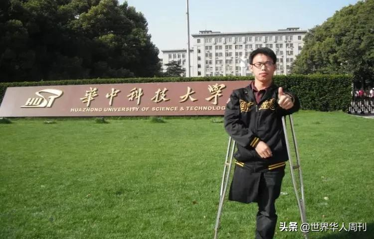 那个成了残疾人的男孩，10年后读博士给自己造了一条腿