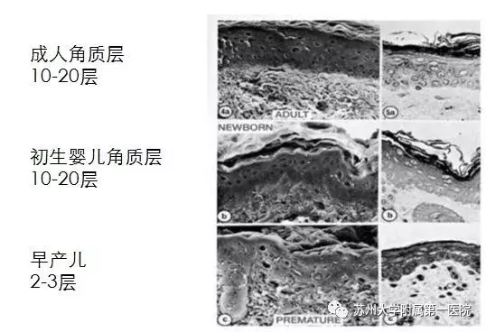 新手爸妈必看好帖！宝宝“红屁股”，爸妈干着急，原来问题出在这