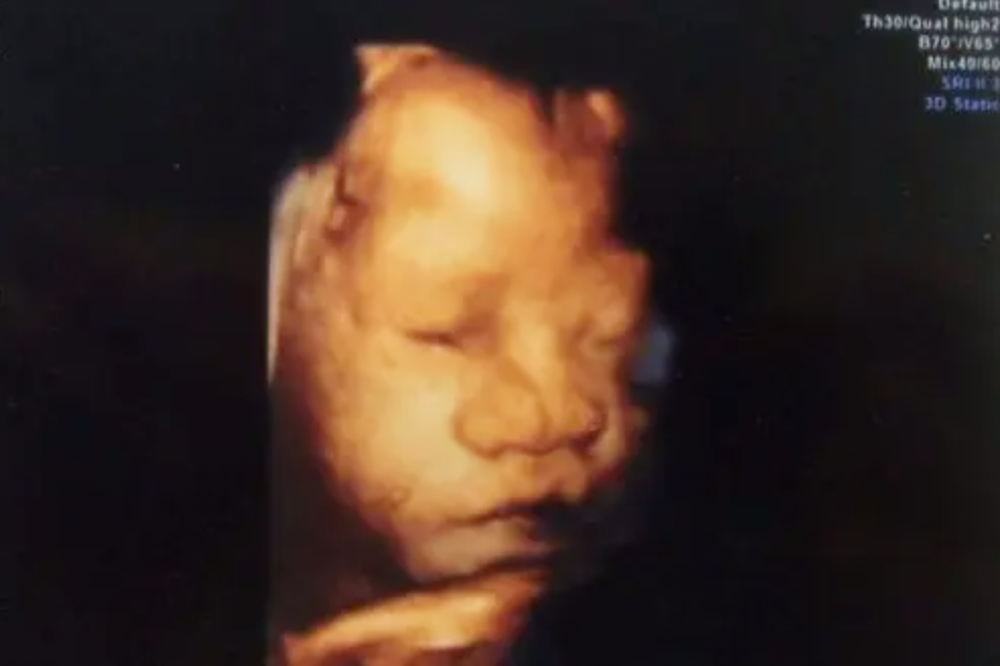 孕期胎儿的四维图像，就是出生时候的模样？别急，后面可能有惊喜