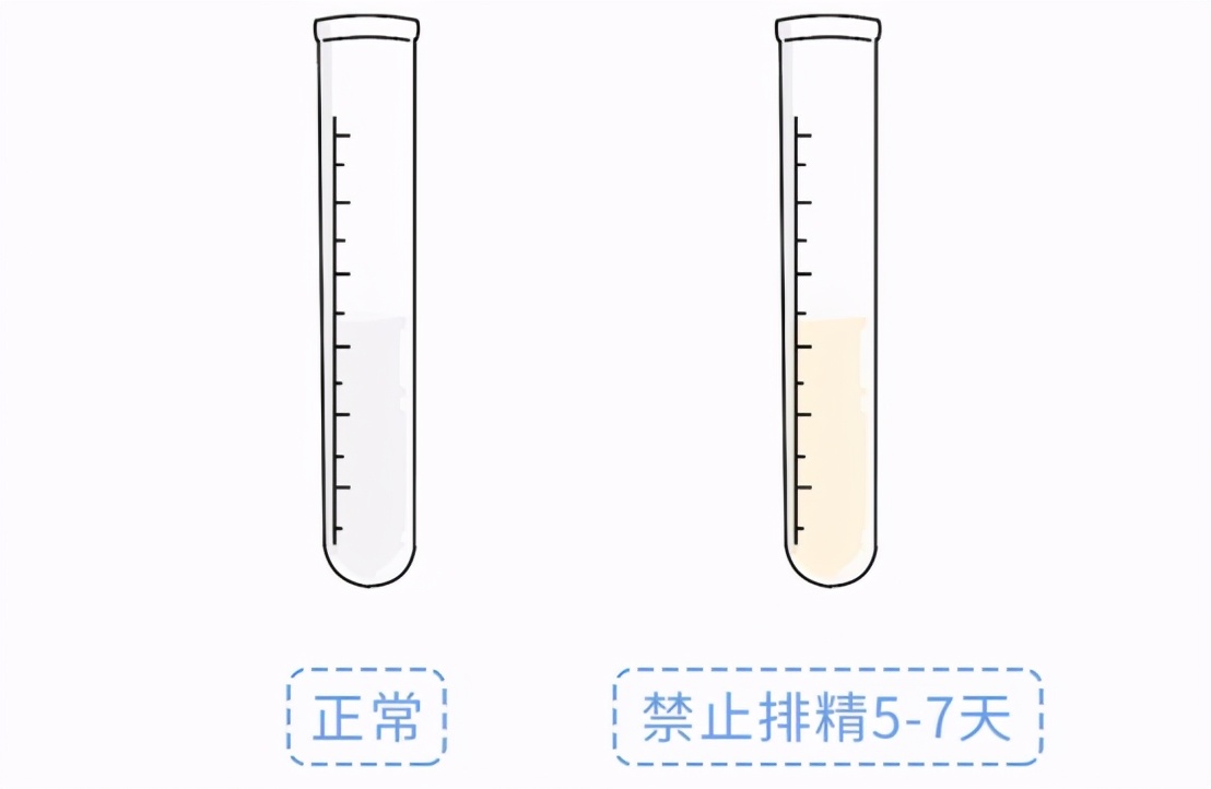 裤子脱掉查一下！泌尿外科里让人“脸红”的病，比一比哪个更尴尬