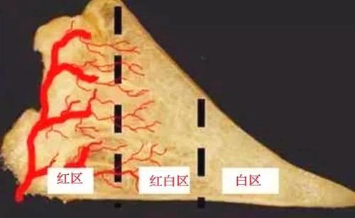 膝盖疼，诊断为半月板撕裂，还能恢复好吗？听听骨科医生怎么说！