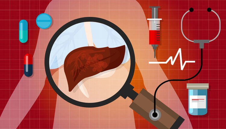 肝功能检查报告，主要看哪几项指标？3个数值“透露”肝脏状态