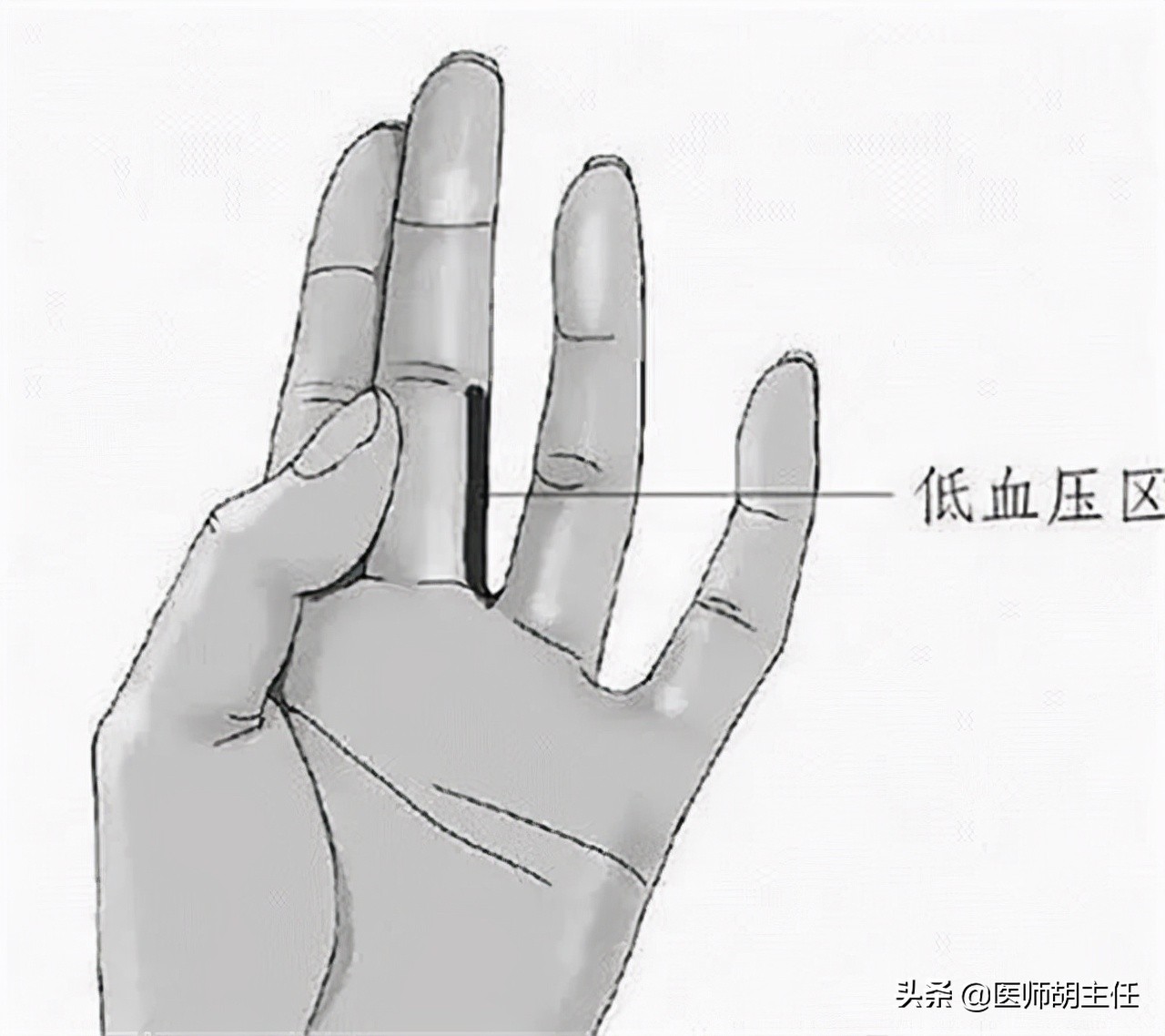 血压中的低压高，要吃什么药？找找自身原因，别急于吃药