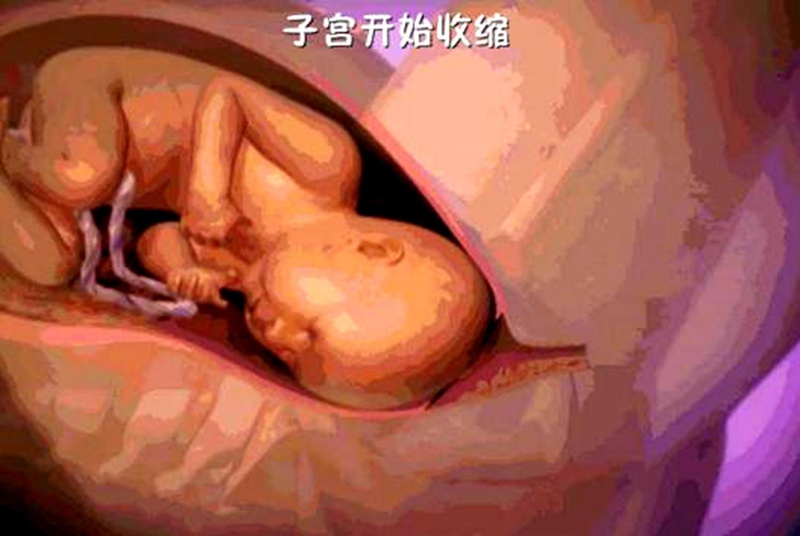怀孕生子不只妈妈在付出，胎宝也很努力，看完分娩过程你也会感动
