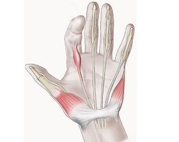 腱鞘炎是怎么引起的