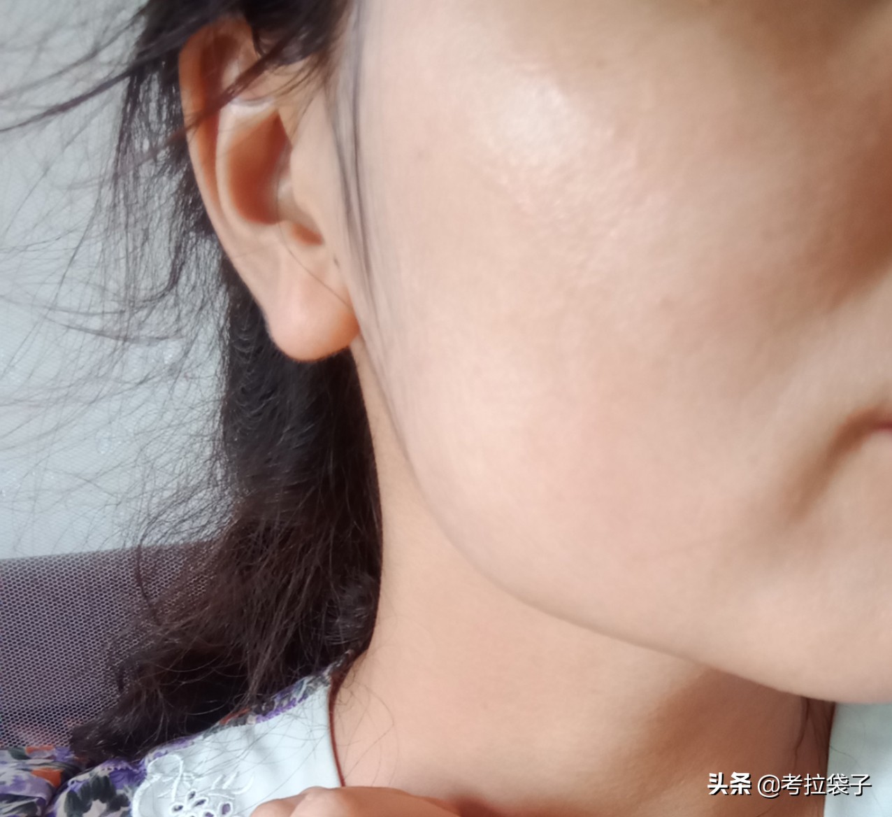 皮肤干燥过敏怎样处理(皮肤干燥过敏用什么护肤品) - 科猫网