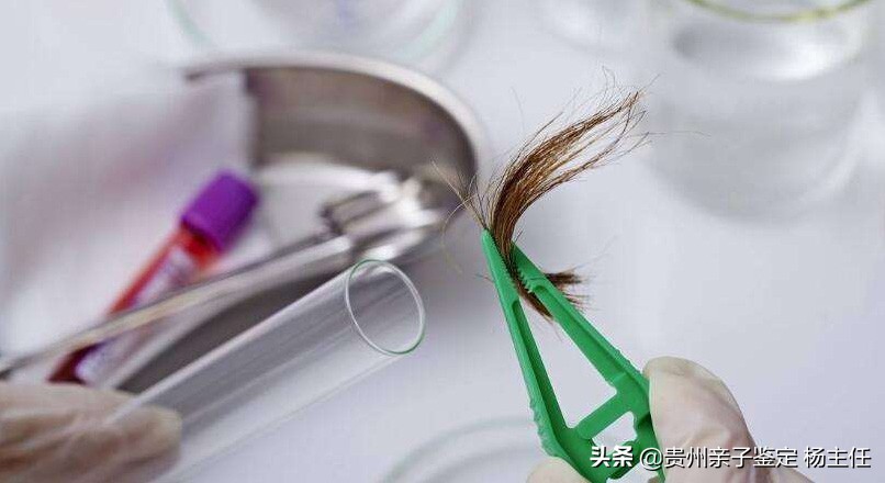 简单的亲子鉴定,如何做亲子鉴定