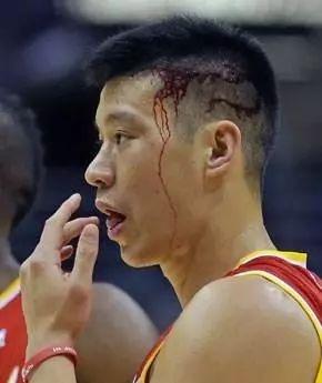 nba球员为什么没人吹肘(真没哨啊，斯玛特在裁判面前把肘子架在林书豪脖子上，裁判都不吹)