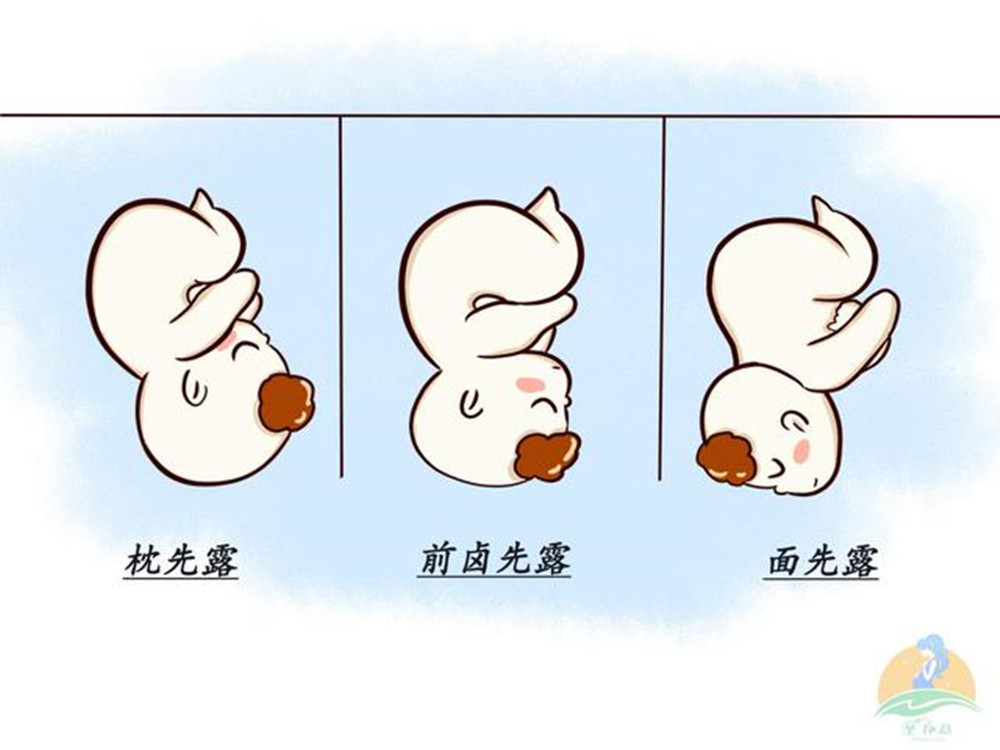 遇上胎位不正的情况，这些纠正方法，孕妈们可以了解一下