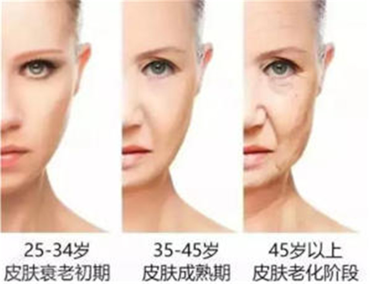 90后逐步走向衰老了！这几款风很大的精华，你确定适合你吗？
