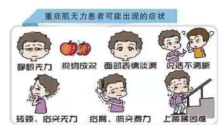 “斜视”不全是眼睛的问题，也可能是神经系统出了毛病