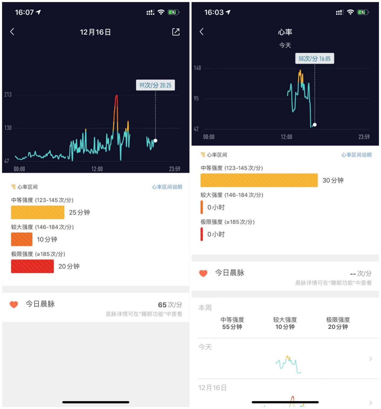 医学认可的测心率手表（性价比最高的医疗级健康手表）