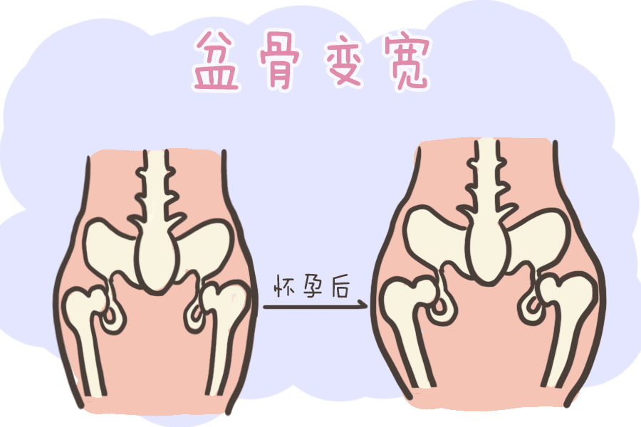 一万二一个小时，高价产后盆骨修复，究竟有必要吗？网友：智商税