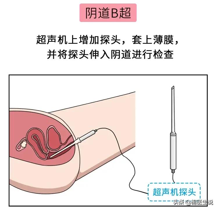 医院让人脸红的“妇科检查”，到底是如何进行的？一次性说清楚！