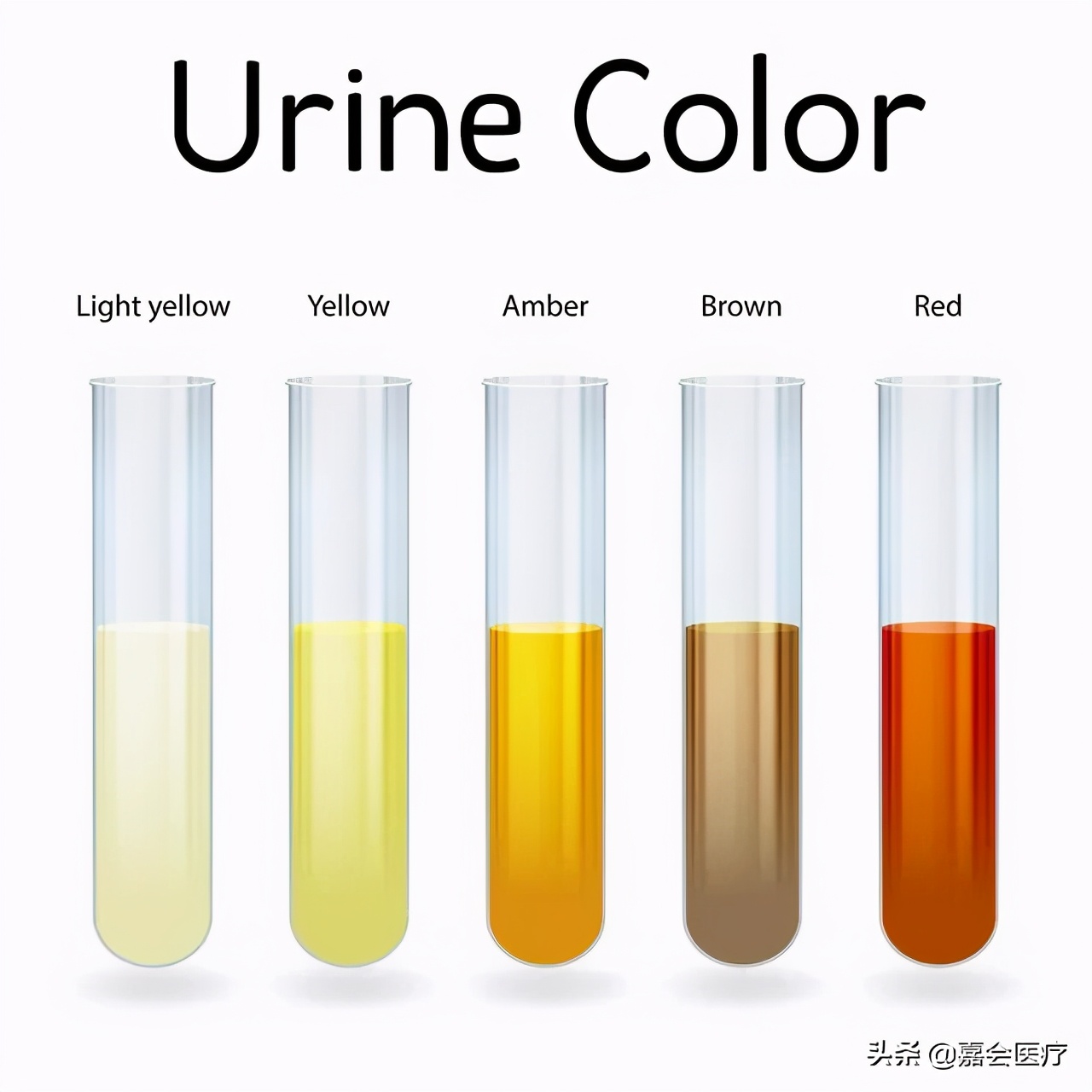 尿出一道彩虹?颜色变化可预示疾病!泌尿科医生的健康建议来了